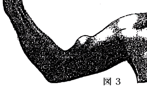 ��r�񓪋ؒf��