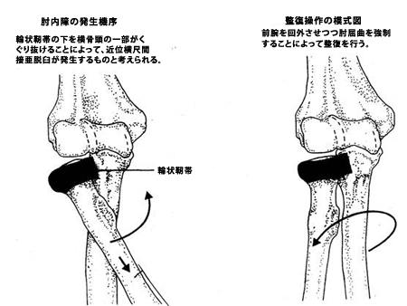 �����I����ɂ���