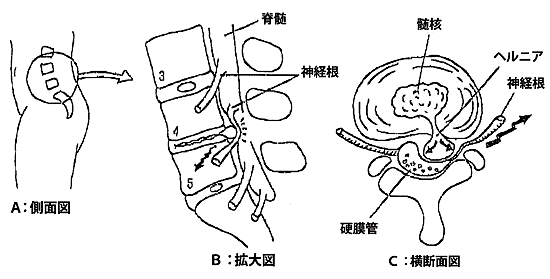 ���ŒŊԔw���j�A�ƍ����_�o�ɂɂ���